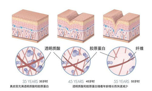 年龄大的皮肤中胶原蛋白和玻尿酸对比图