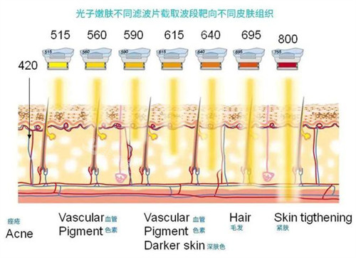 光子嫩膚不同濾波片<span style=