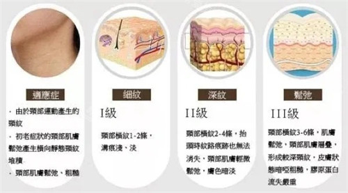 嗨體適用部位以及原理動畫圖