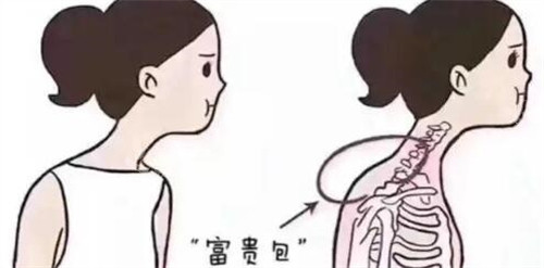 脖子富貴包卡通圖展示照片 脖子富貴包卡通圖展示照片