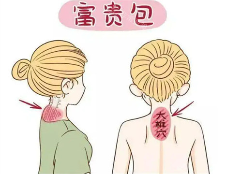 富貴包位置圖示 富貴包位置圖示