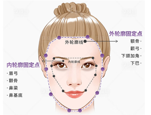 內(nèi)外輪廓固定圖示 內(nèi)外輪廓固定圖示