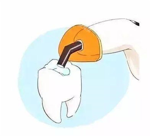 根管沖洗消毒動畫圖