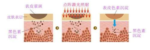 【官方】韩国vos皮肤科医院在线预约！打啵啵 仪器美肤热门项目需要提前预约！