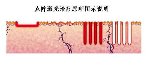 韩国PAGE LAB皮肤科医院好吗？打啵啵和设备仪器美肤在韩口碑超级好！