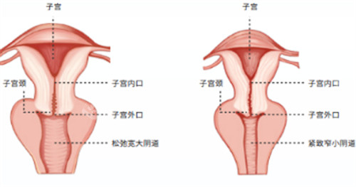 阴道紧缩术施术位置图解