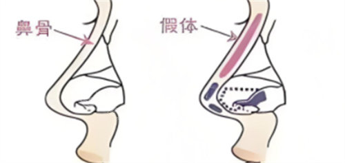 韩国vanny整形医院好吗？技术靠谱 微整项目口碑也非常好！