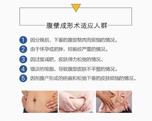 腹壁成形術(shù)適應(yīng)癥 腹壁成形術(shù)適應(yīng)癥