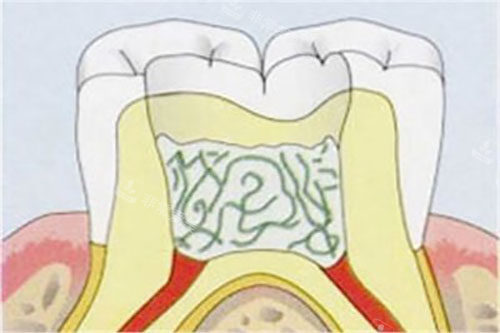 活髓切断示意图