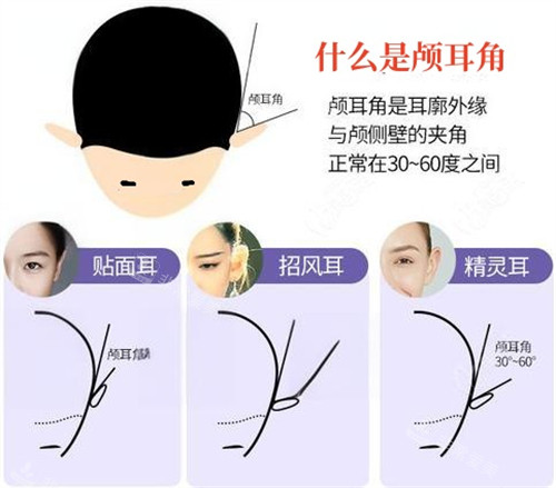 什么事颅耳角动画演示图 什么事颅耳角动画演示图