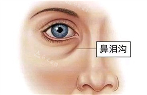 淚溝位置展示動畫圖 淚溝位置展示動畫圖