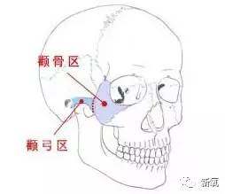 顴骨骨骼圖 顴骨骨骼圖