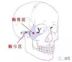 韩国颧骨内推医生排名！全是整友反馈整理筛选出来的靠谱医生！