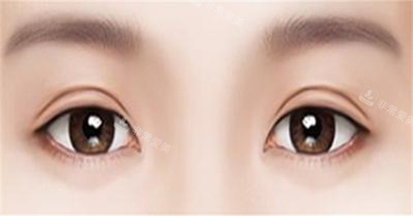香腸眼照片 香腸眼照片