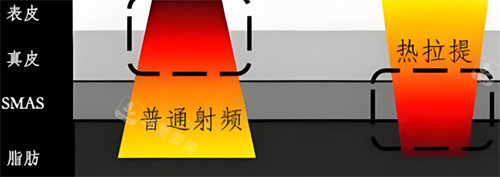 韩国skinique皮肤科怎么预约?中文室长在线为你解答到院路线及预约方式~