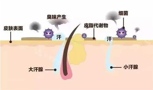 狐臭怎么產(chǎn)生的