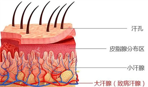 为什么会腋臭