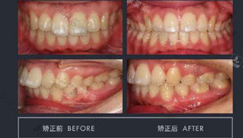 苏州拜博口腔牙齿矫正