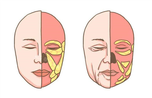 面部衰老卡通圖對(duì)比