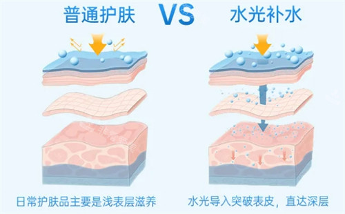 韩国水光注射很便宜吗?亲身经历告诉你真的嘎嘎划算,改善皮肤问题也也不错哟~