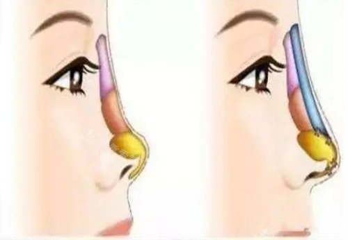 ​30岁女性适合做的整形项目：皮肤抗衰美容/眼鼻整形可提升个人魅力！