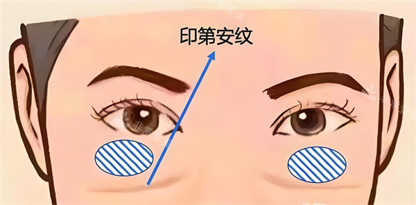 印第安紋位置圖示 印第安紋位置圖示