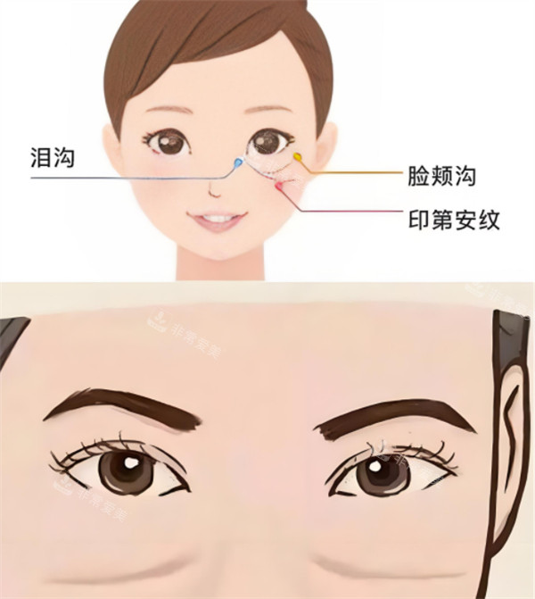 不同衰老紋的位置圖 不同衰老紋的位置圖