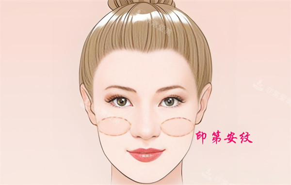 印第安紋位置展示 印第安紋位置展示