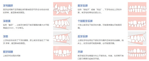 牙齿畸形的不同症状