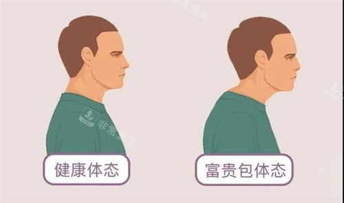 富貴包和健康體態(tài)對(duì)比動(dòng)畫圖