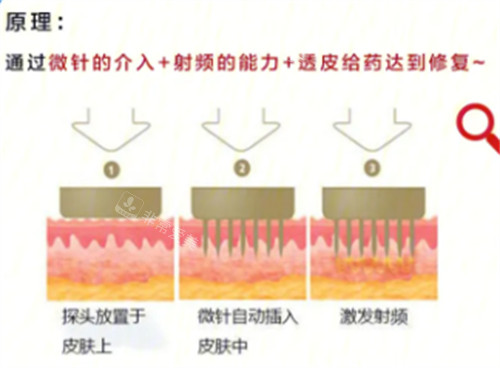 在线整理:韩国goldj皮肤科官网简介资料!到院地址-特色项目为你解答它家怎么样!