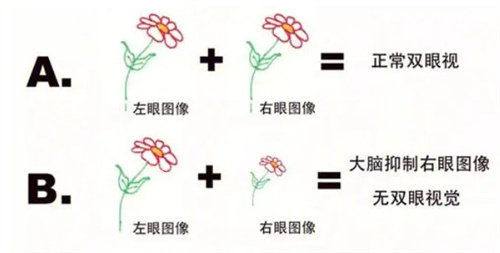 双眼检查