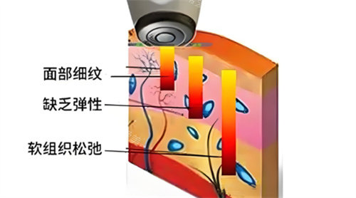 熱拉提作用 熱拉提作用