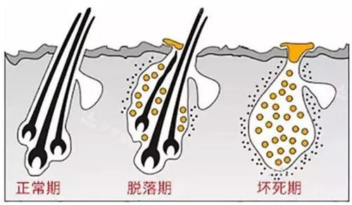 頭發(fā)生長(zhǎng)周期圖解