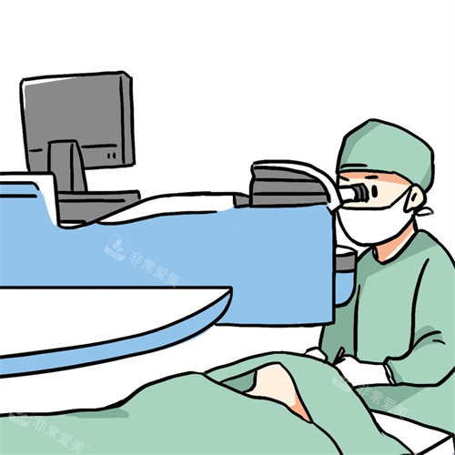 双眼皮手术演示动画图