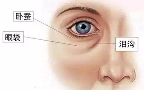 眼周不同結(jié)構(gòu)及名稱示意圖 眼周不同結(jié)構(gòu)及名稱示意圖