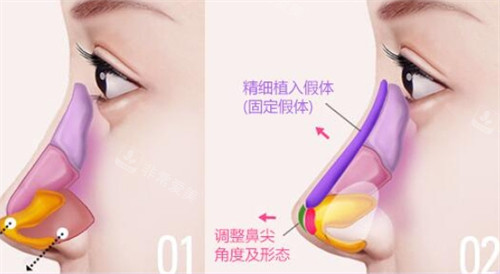 南宁千寻医学美肤怎么样正规吗?是连锁轻医美很靠谱且口碑好,附简介地址!