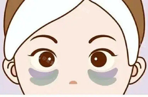 不同位置黑眼圈顏色卡通示意圖 不同位置黑眼圈顏色卡通示意圖