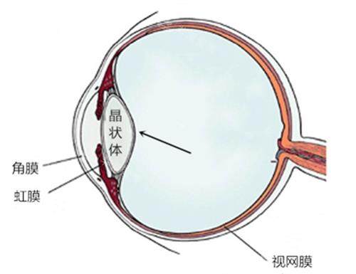 眼球结构图