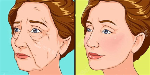 面部除皱前后对比演示动画图