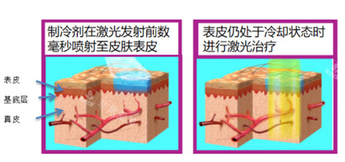 595染料激光原理