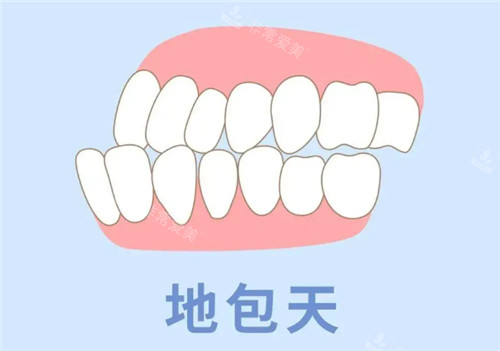 地包天动画图