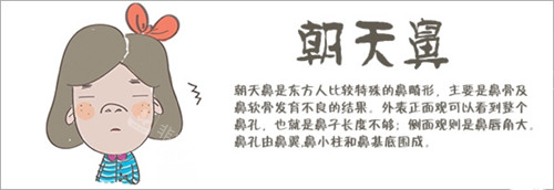 什么是朝天鼻