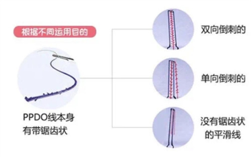 PPDO 線的不同形狀 PPDO 線的不同形狀