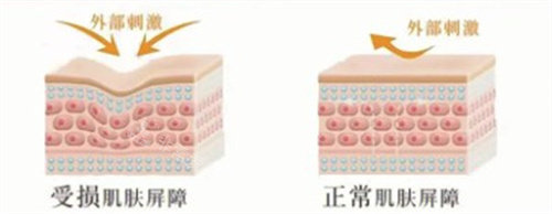 皮膚屏障受損 皮膚屏障受損