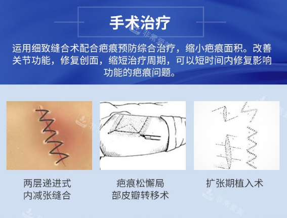 非手术祛疤的原理