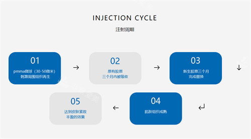 贝丽菲尔bellafill注射周期