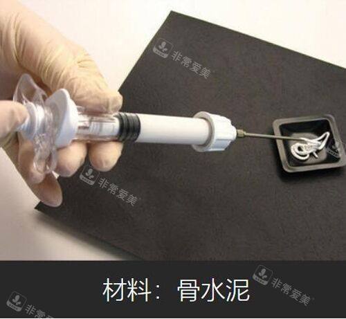 骨水泥材料實物展示圖 骨水泥材料實物展示圖