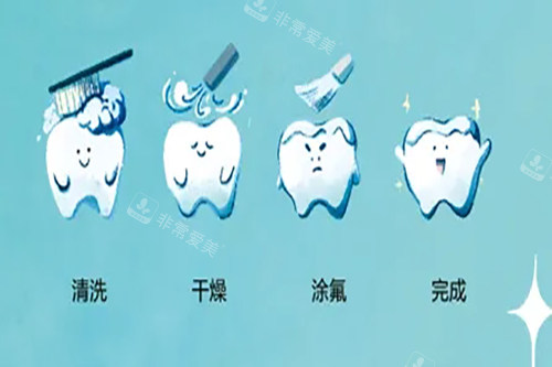 牙齿涂氟卡通示意图