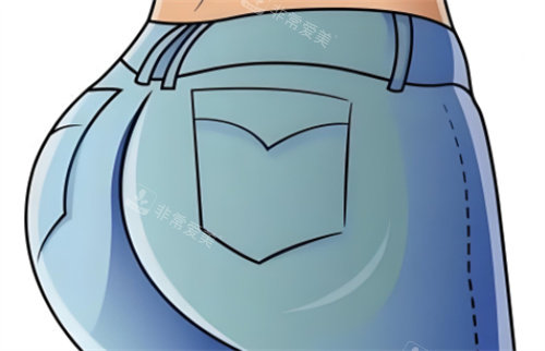 豐臀術(shù)后呈現(xiàn) 豐臀術(shù)后呈現(xiàn)